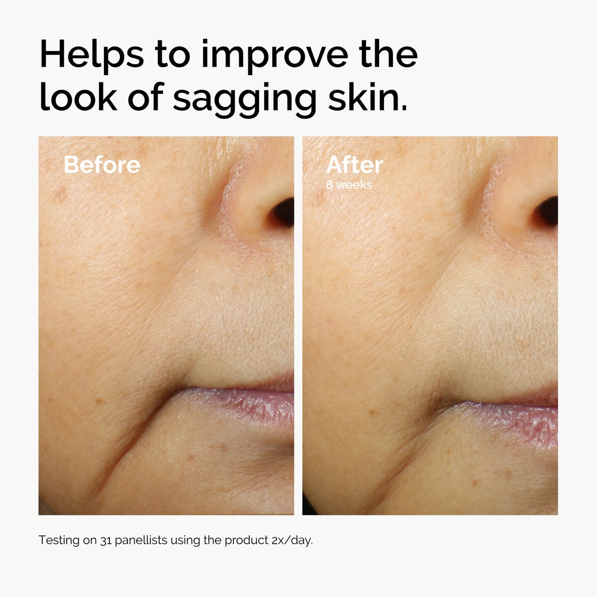 caffeine-3-escin-1-face-serum-l2 ord-caffeine-3pct-escin-1pct-face-serum-before-after-sagging.jpg