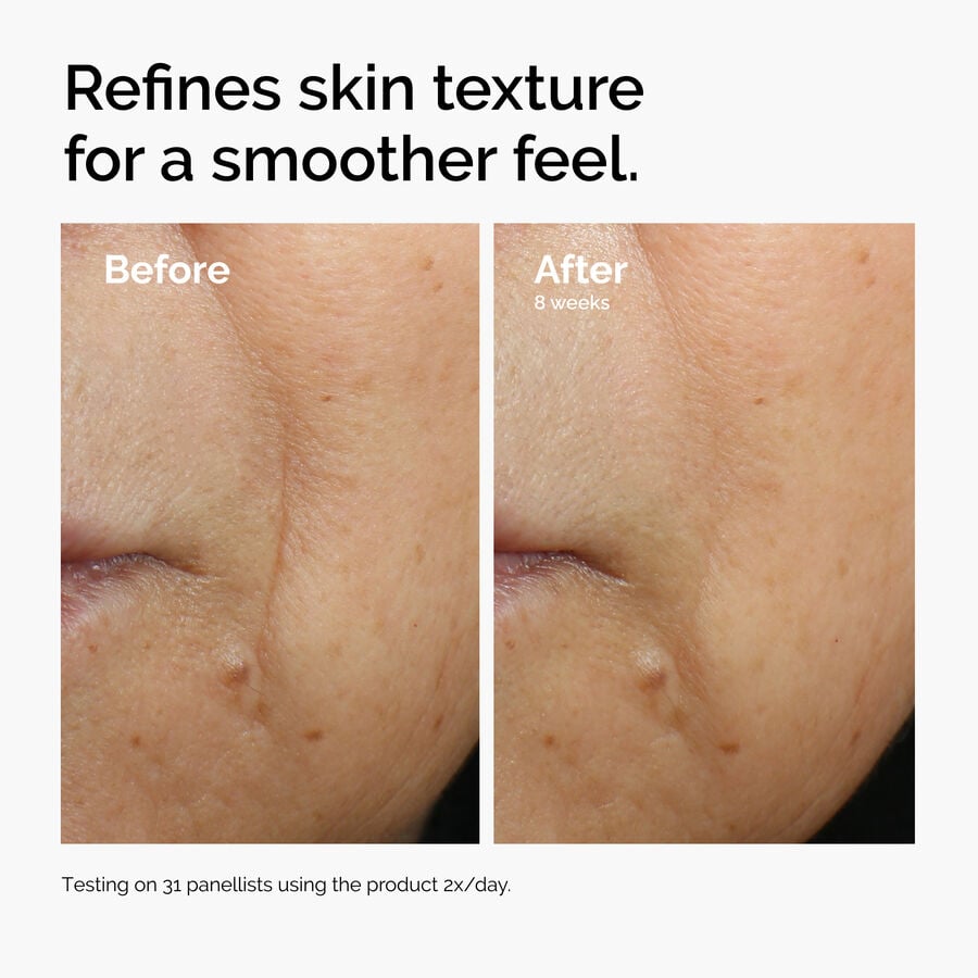 caffeine-3-escin-1-face-serum-l2 ord-caffeine-3pct-escin-1pct-face-serum-before-after-texture.jpg