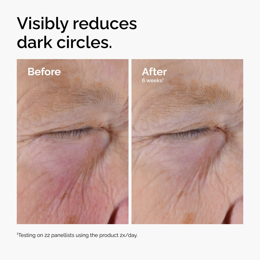 caffeine-solution-5-egcg-eye-serum-j7 ord-caffeine-solution-egcg-dark-circles-before-after.jpg