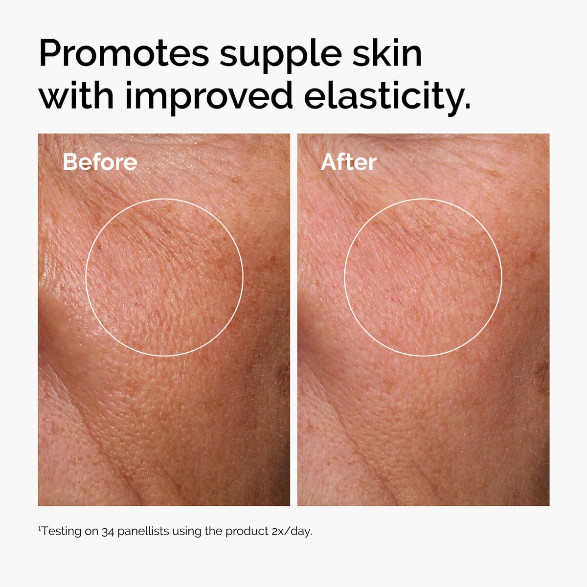 hyaluronic-acid-2-b5-with-ceramides-h0 ord-hyaluronic-acid-2pct-b5-hydrating-serum-before-after-elasticity.jpg