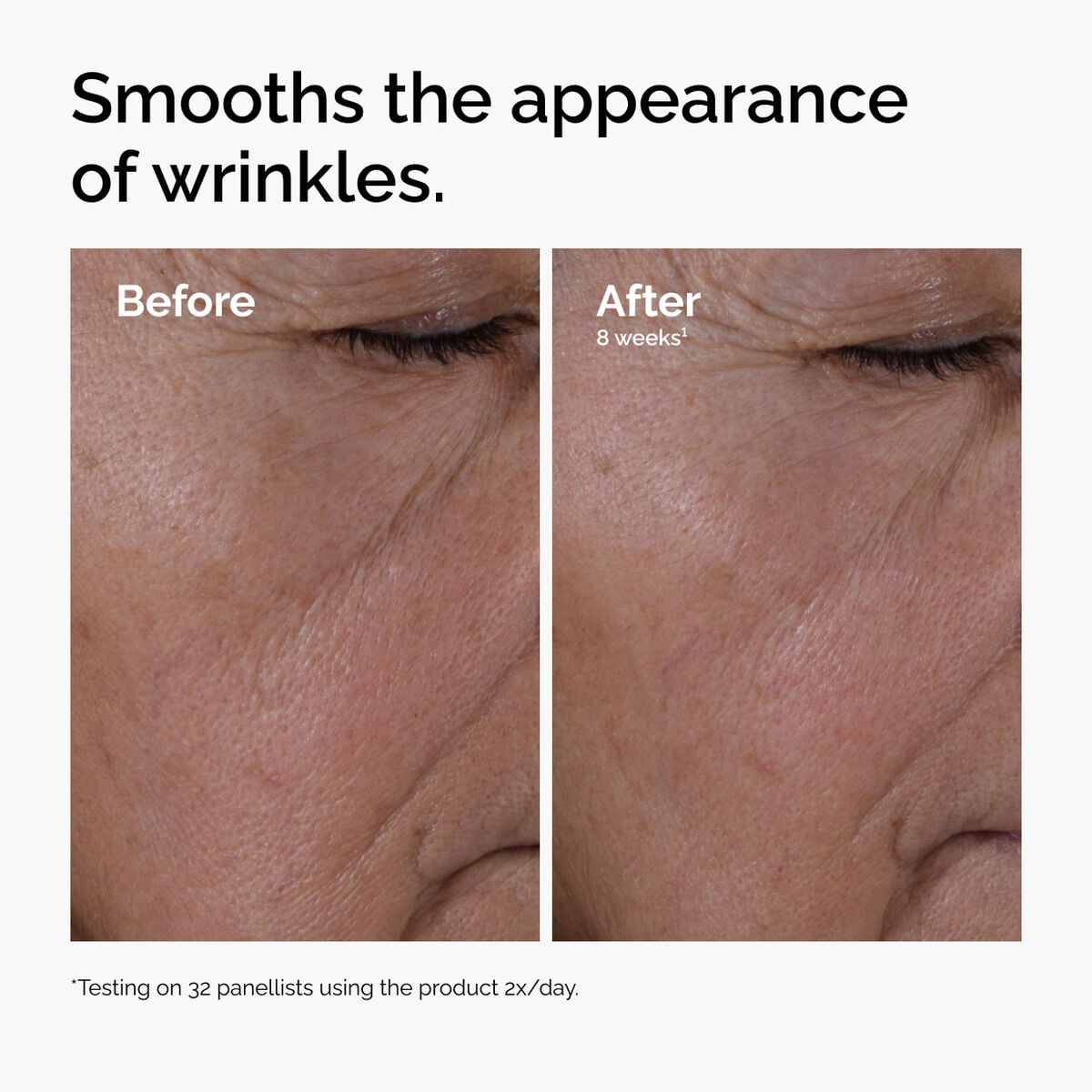 multi-peptide-ha-serum-h4 ord-multi-peptide-ha-serum-wrinkles-before-after.jpg
