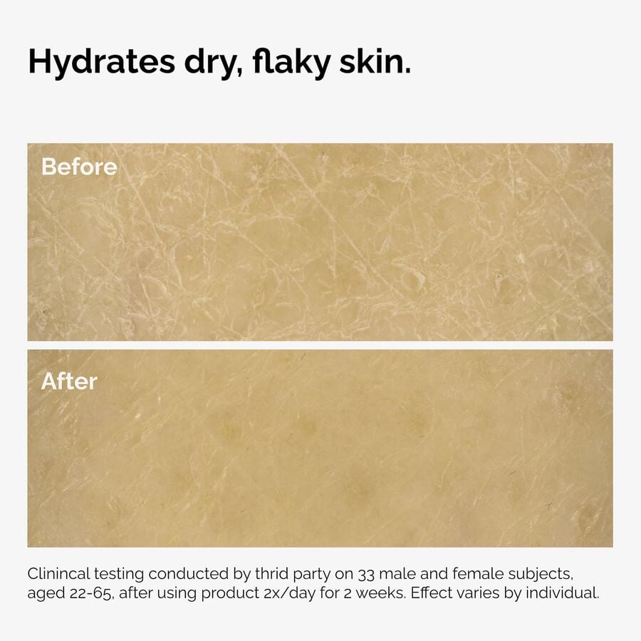 the-body-care-collection-c2 ord-natural-moisturizing-factors-inulin-body-before-after-graphic-02.jpg