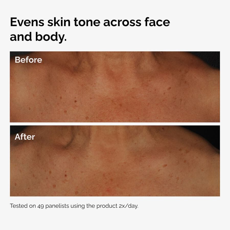 the-body-care-collection-c2 ord-niacinamide-face-body-serum-before-after-even-tone-graphic.jpg