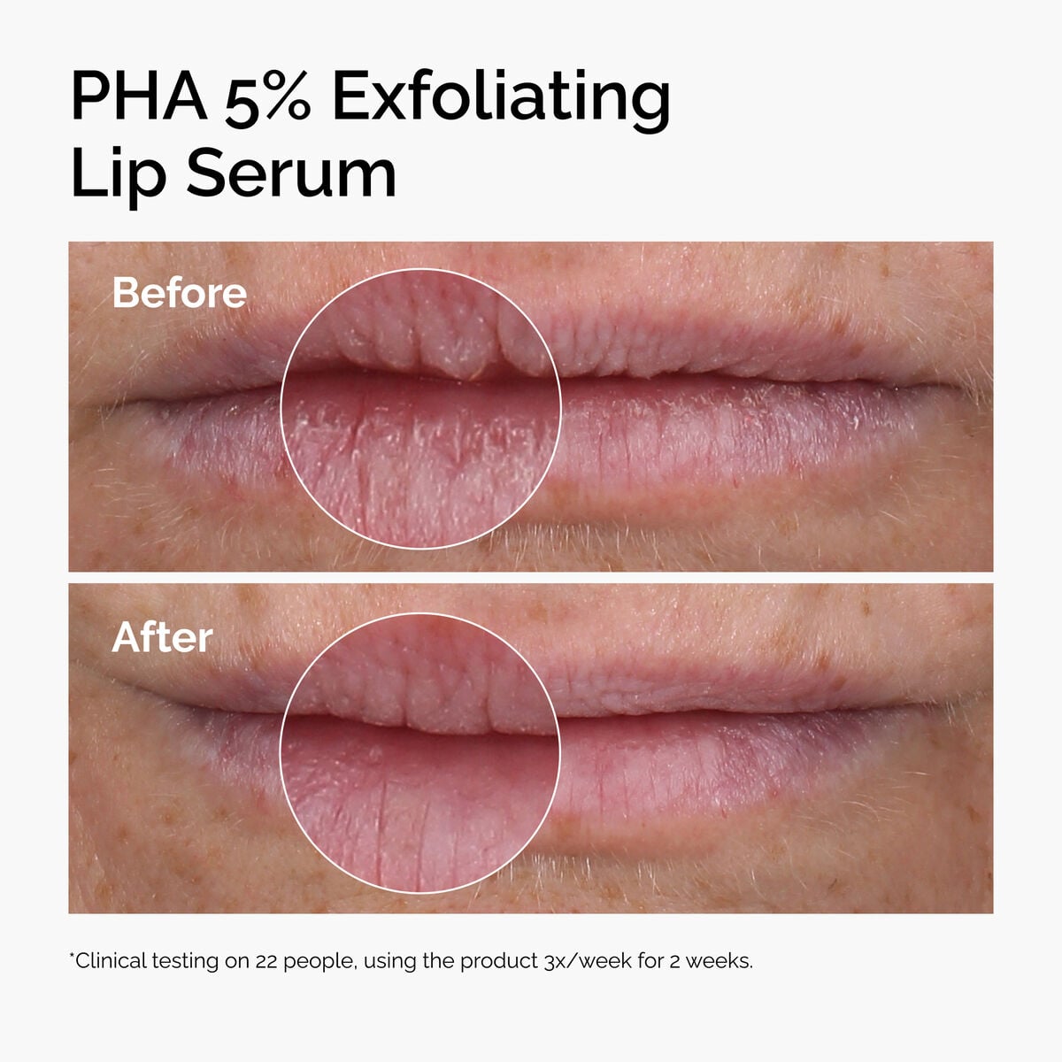 pha-5-exfoliating-lip-serum-o0 ord-pha-5pct-lip-exfoliating-serum-before-after.jpg