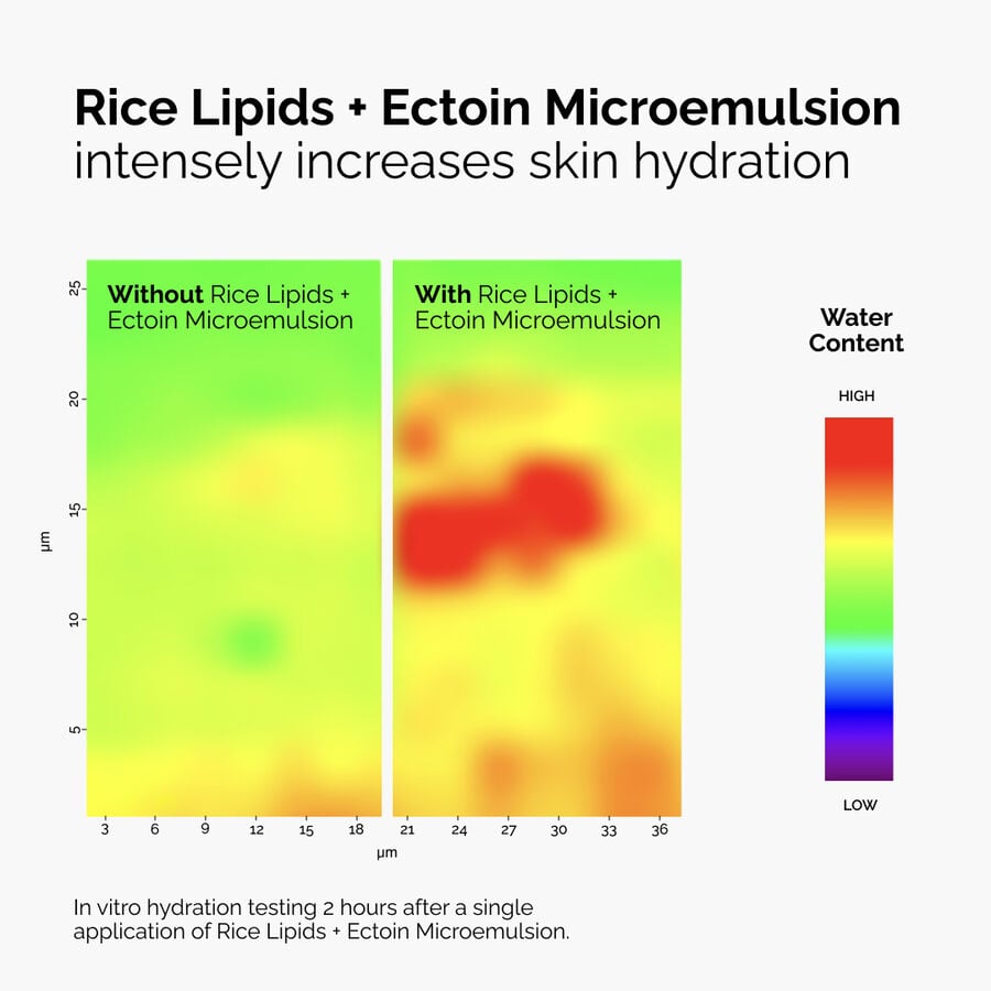 rice-lipids-ectoin-microemulsion-u8 ord-rice-lipids-ectoin-microemulsion-thermal-before-after.jpg